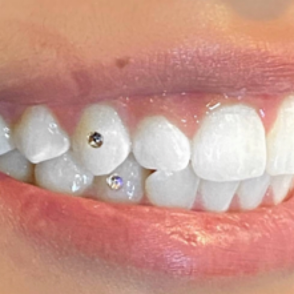 Tooth Gem at Kaida Skin + Beauty in Stony Point, NY