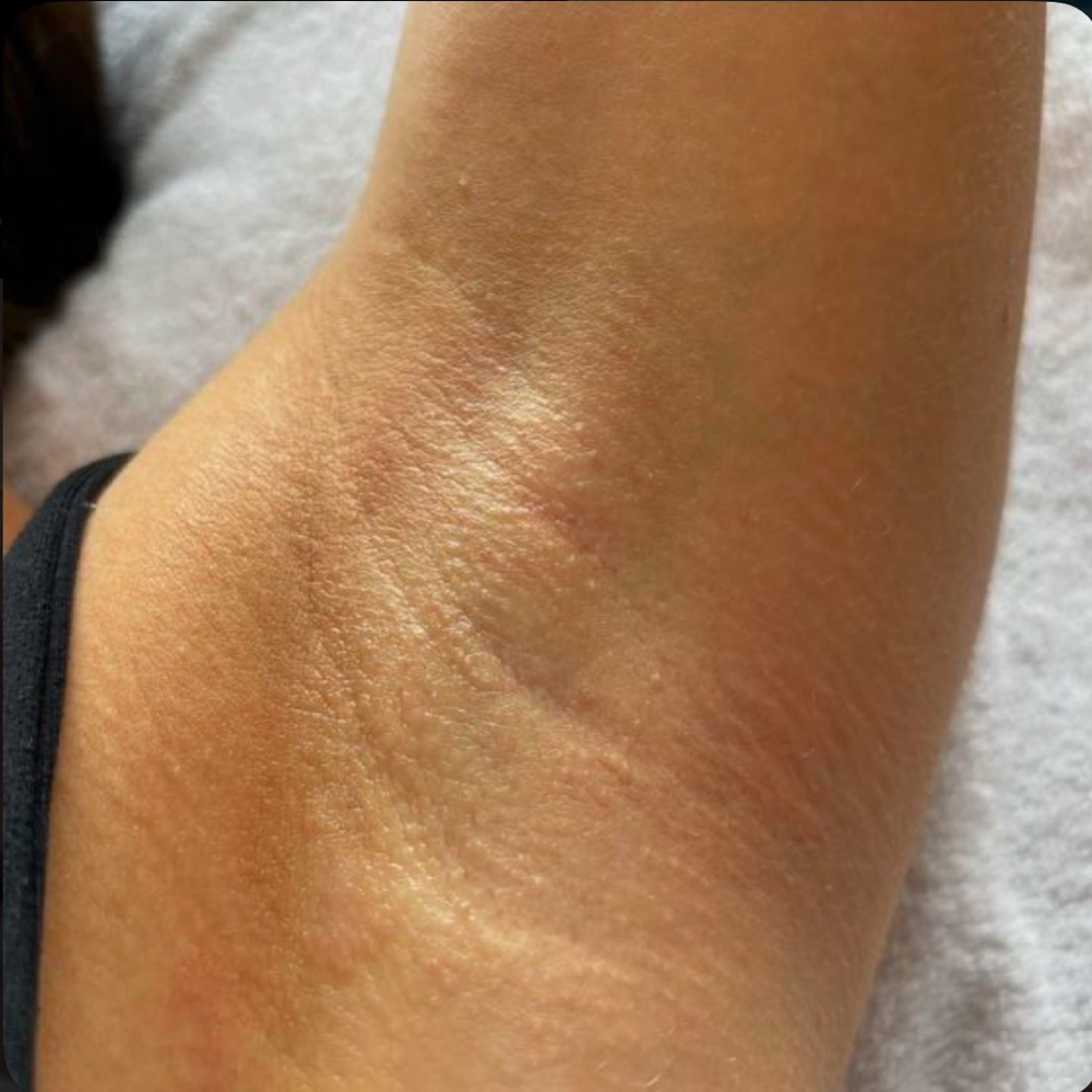 Underarm Wax at Kayle Rae Esthetics in Windham, ME