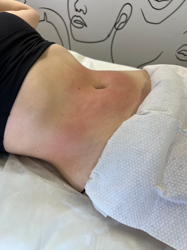 Jordi Shape – Stomach Lymphatic Mas