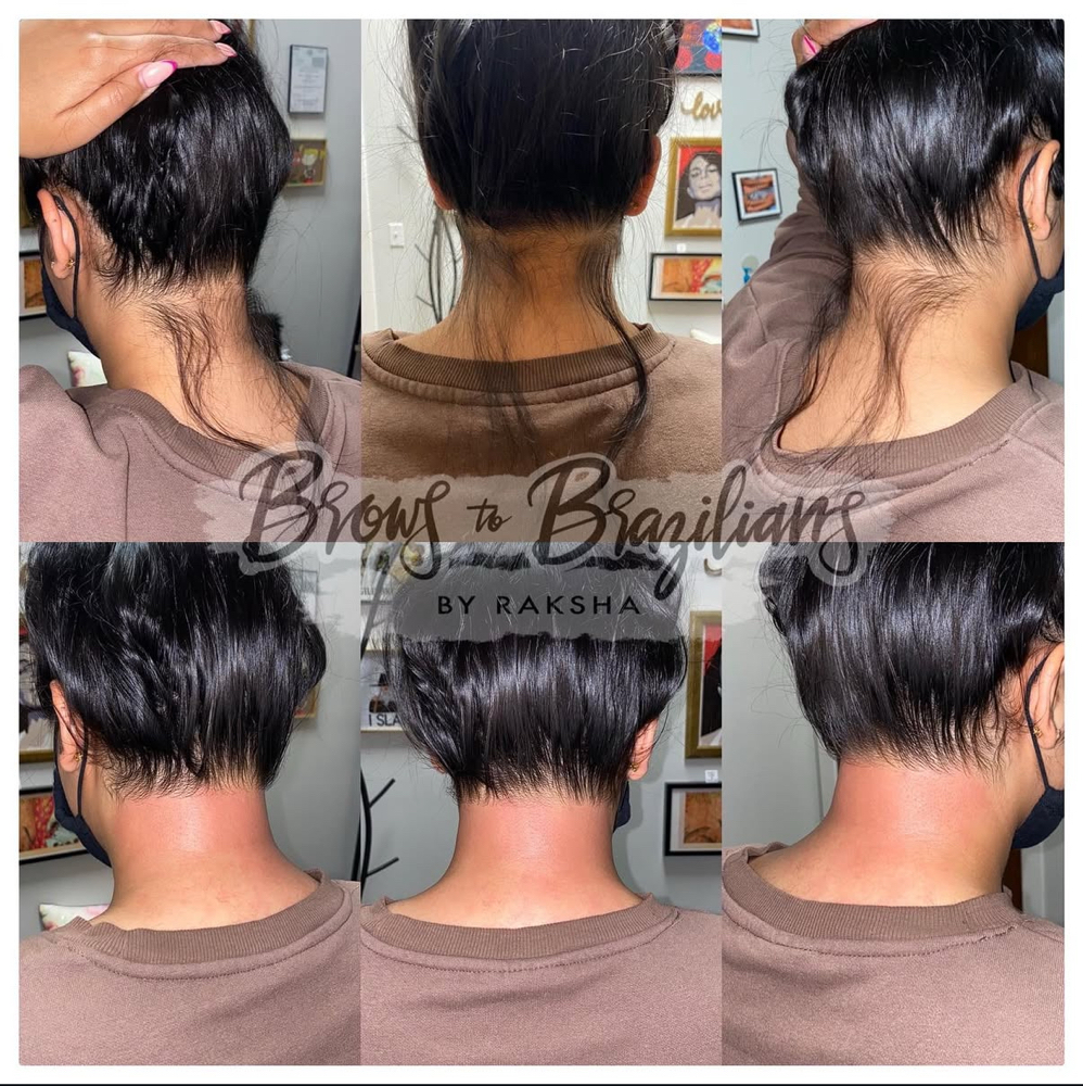 Hairline/Back of Neck