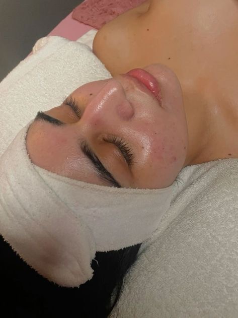 Cooling Facial