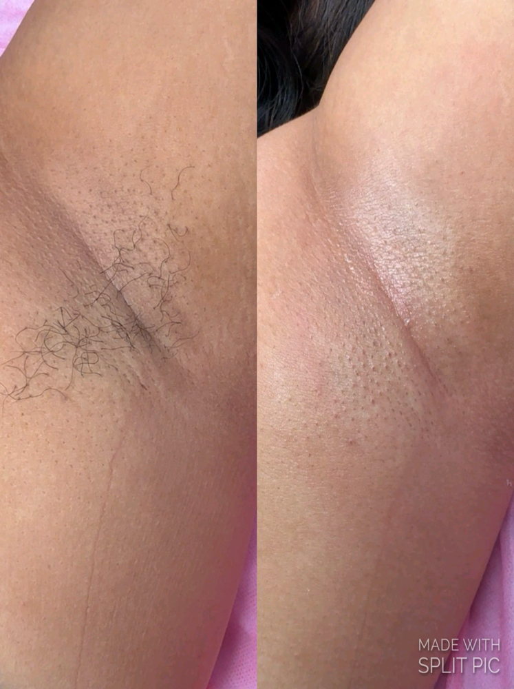 Under Arm Wax(Depilacion de Axilas)