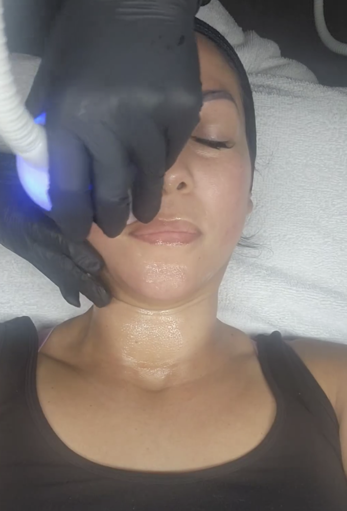 NEVESKIN FACE "Cold" Facial