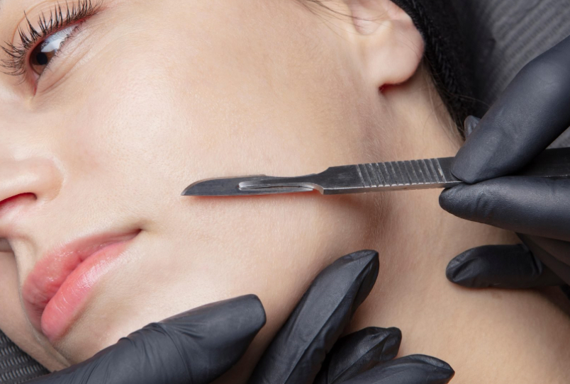 Dermaplaning Gold