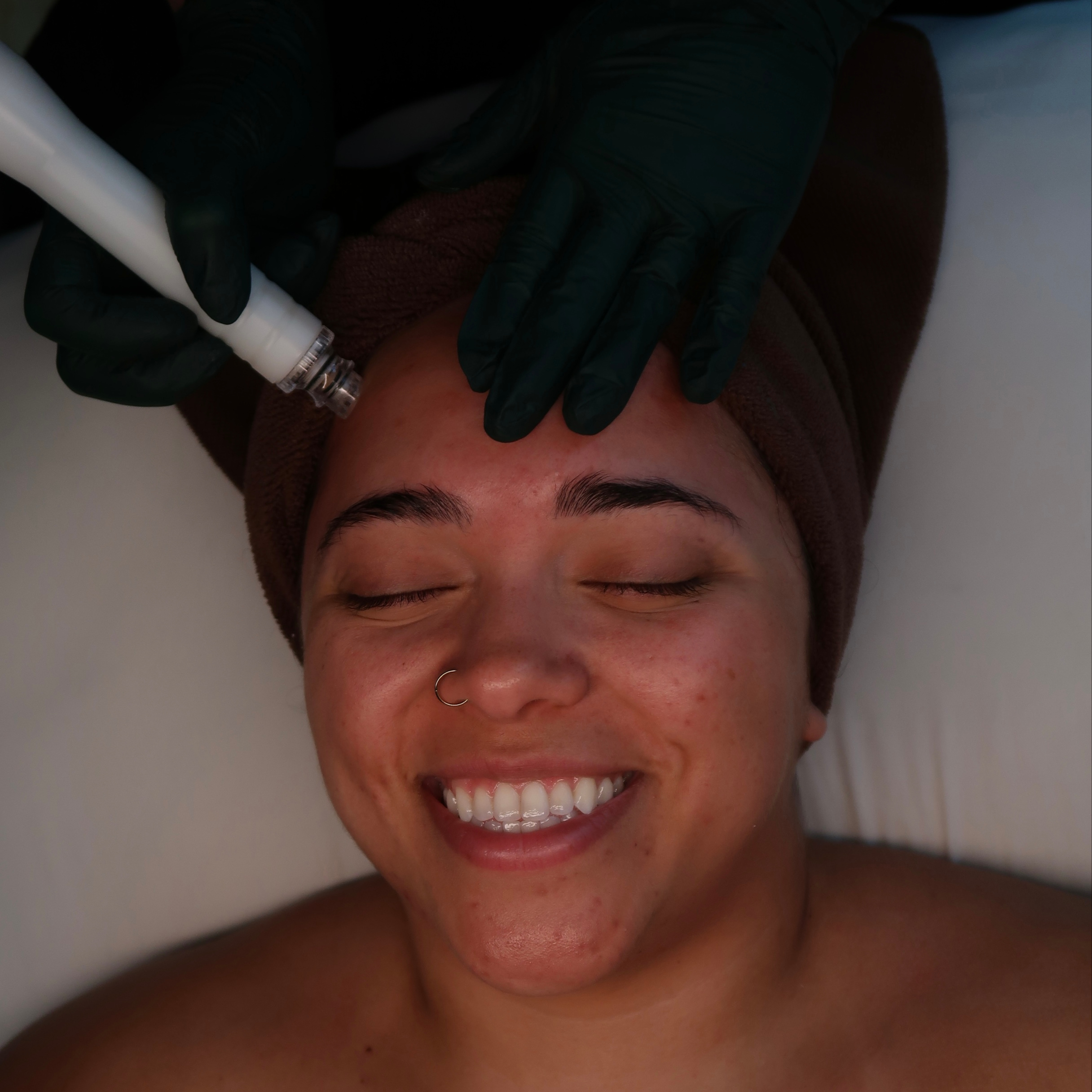 HydroLuxe Skinwave Renewal at Alchemy Aesthetics in University Place, WA