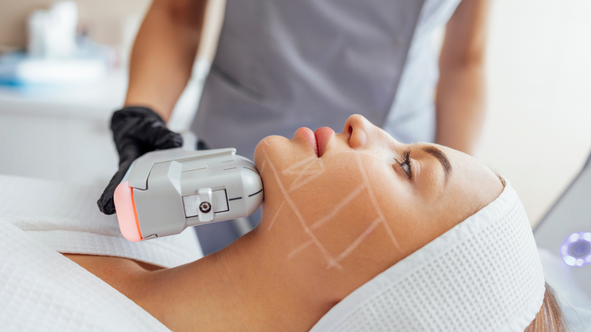 Ultherapy HIFU Face & Body