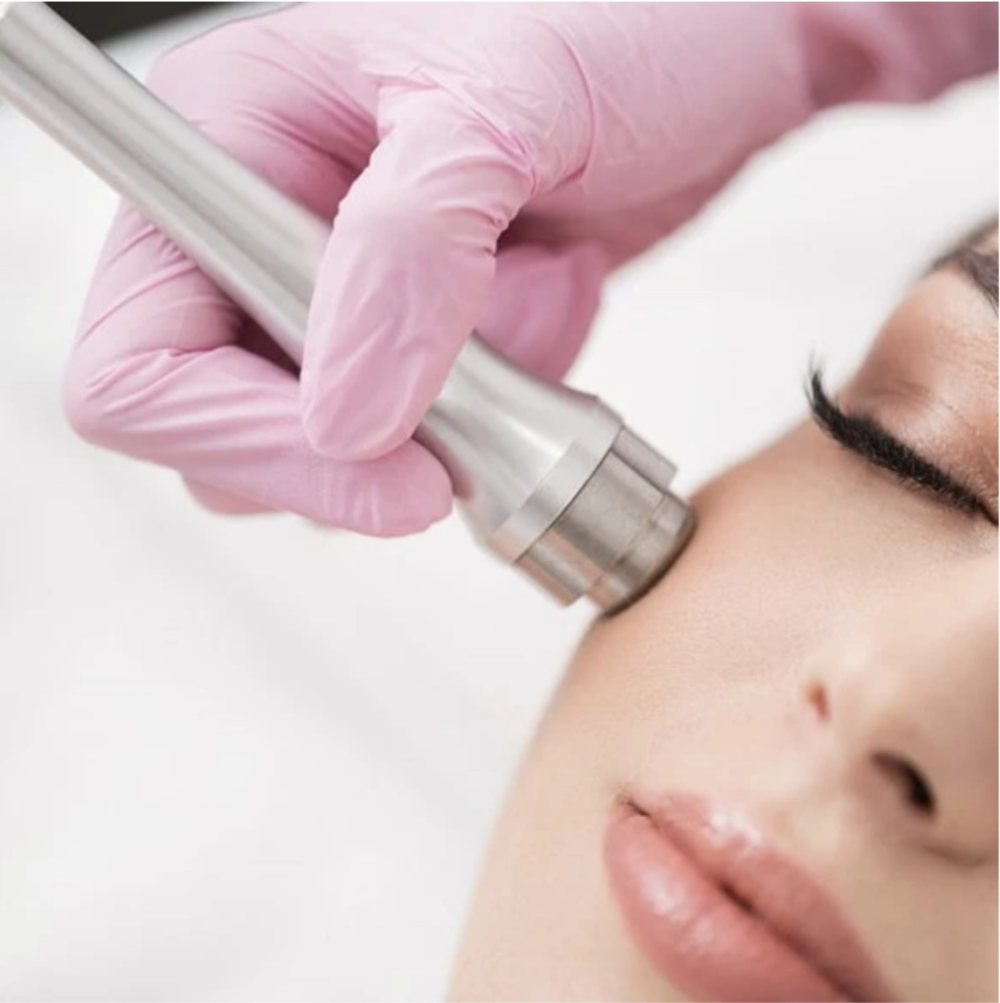 Microdermabrasion Facial