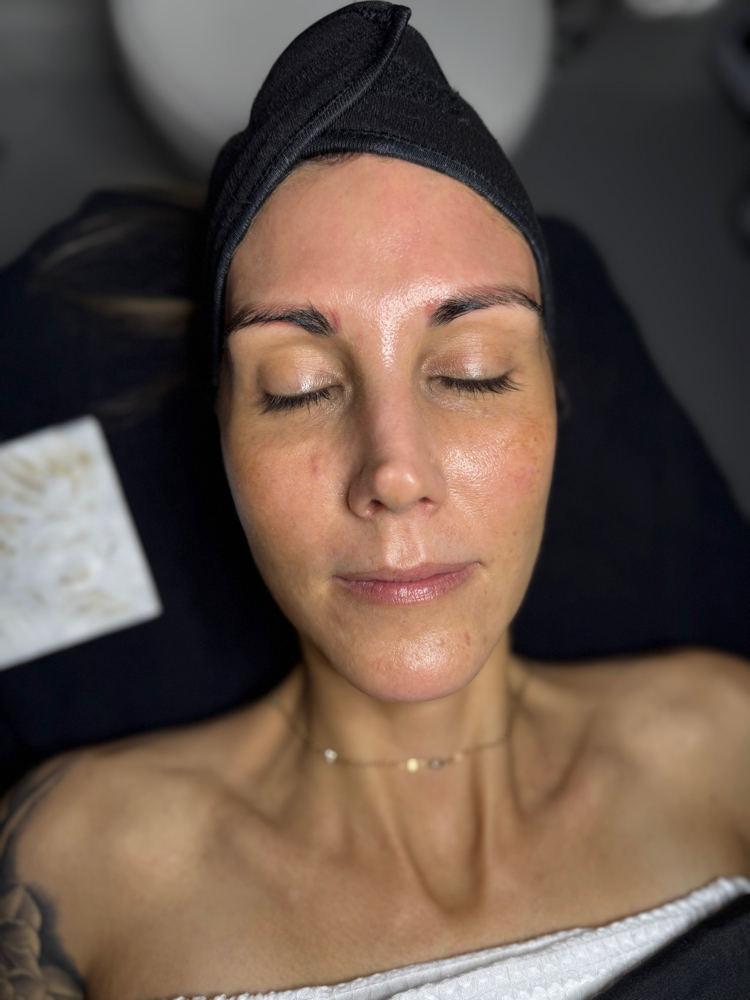 Dermaplane Facial