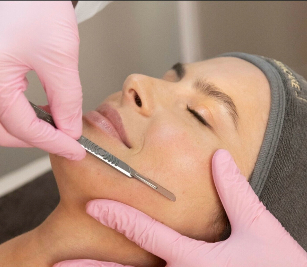 Dermaplane Facial