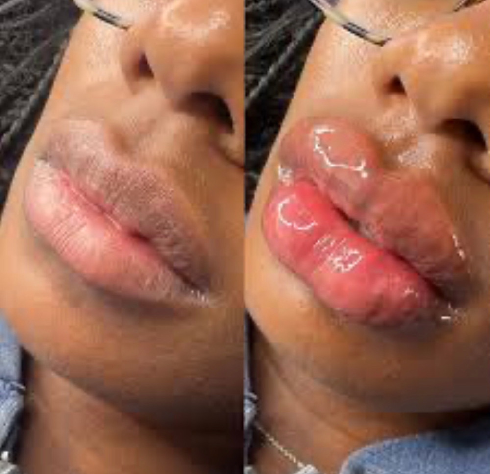 RUSSIAN WAVE LIP FILLERS ~ 2 ML