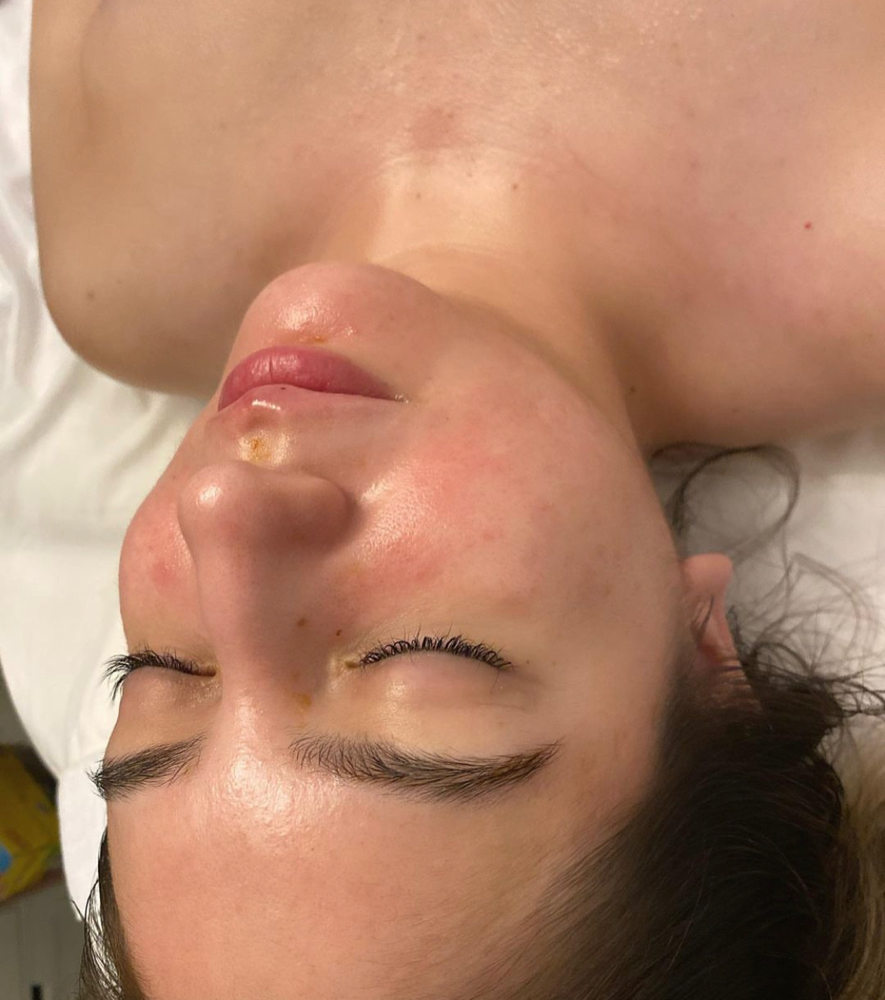 Basic Facial