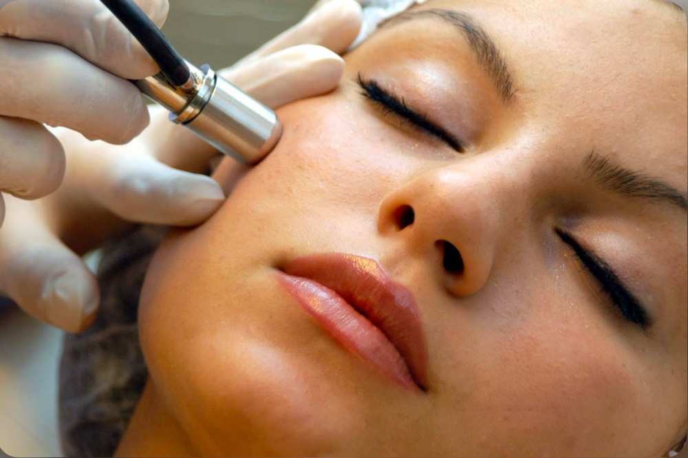 Microdermabrasion Facial