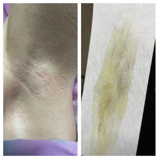Underarm Wax