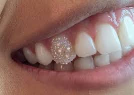 Chandelier/ Pixie Tooth