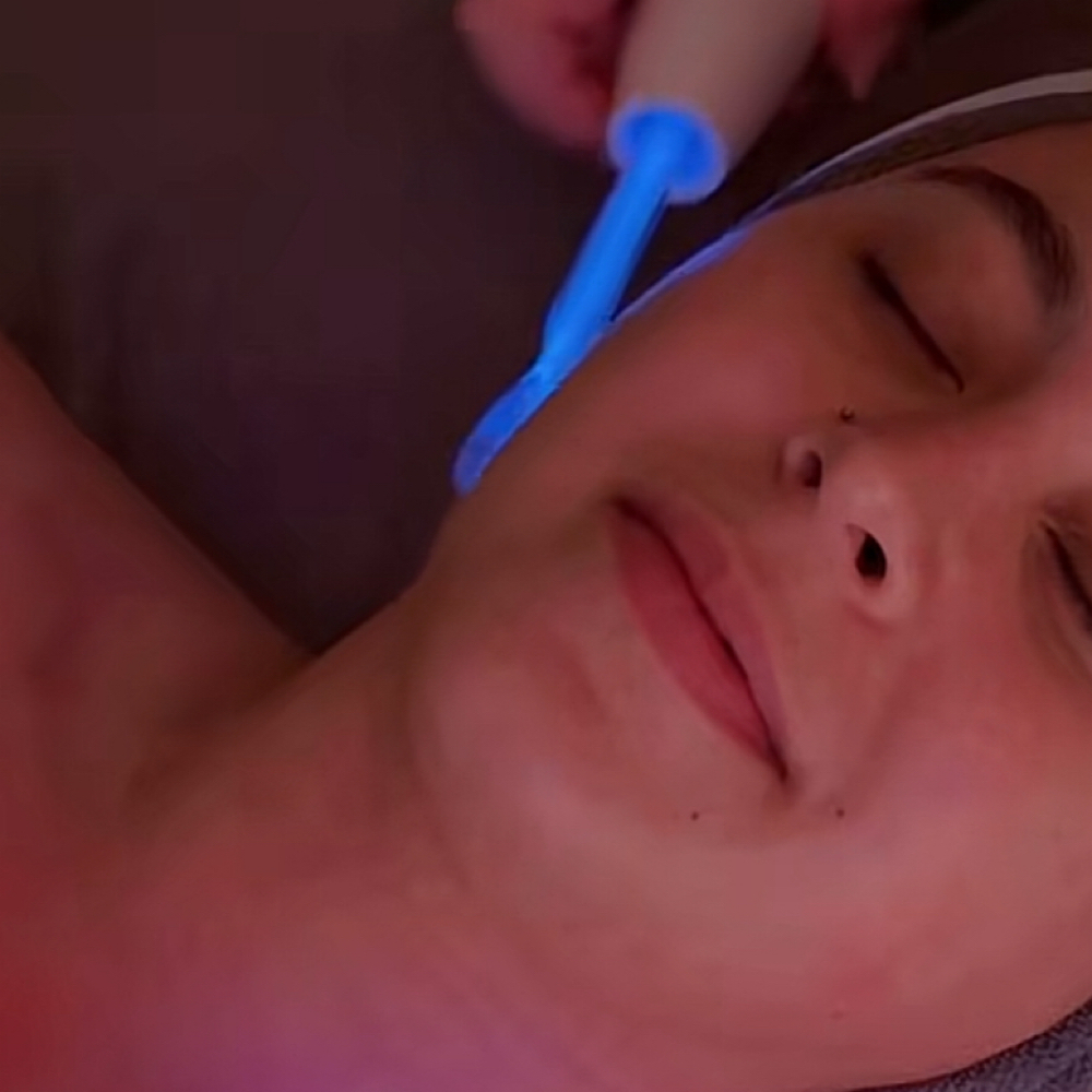 High Frequency - Argon at Golden Moon Esthetics, LLC in Frisco, TX