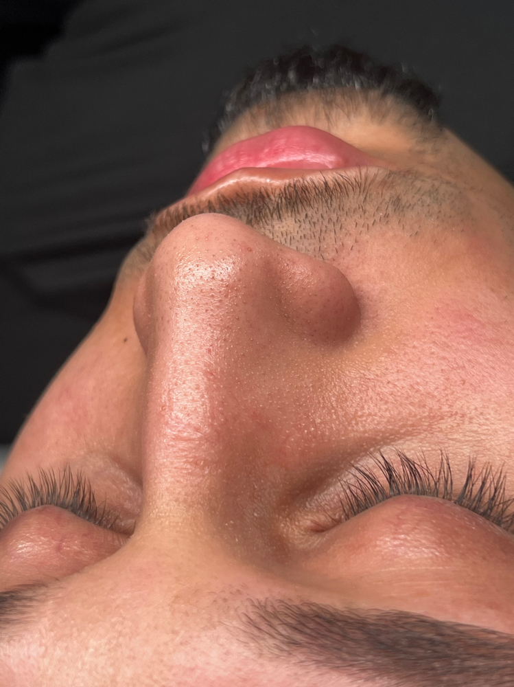 Black Head Cleaning at Ashlashbeauty in Akron, PA