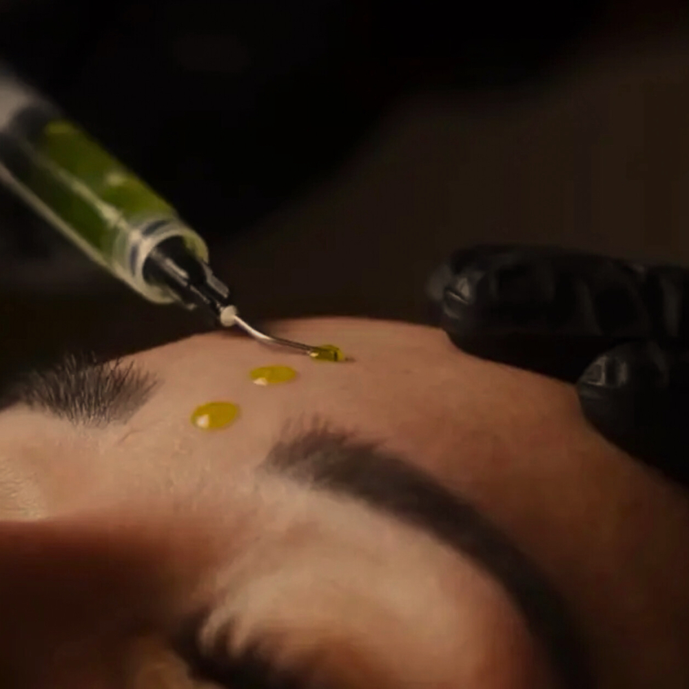 BioRePeel at The Skin Study in Huntington, WV