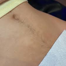 Stomach Strip