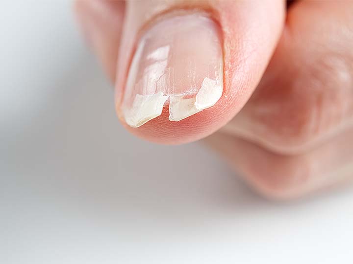 Nail Fix at TT NAILS & WELLNESS in Fresno, CA