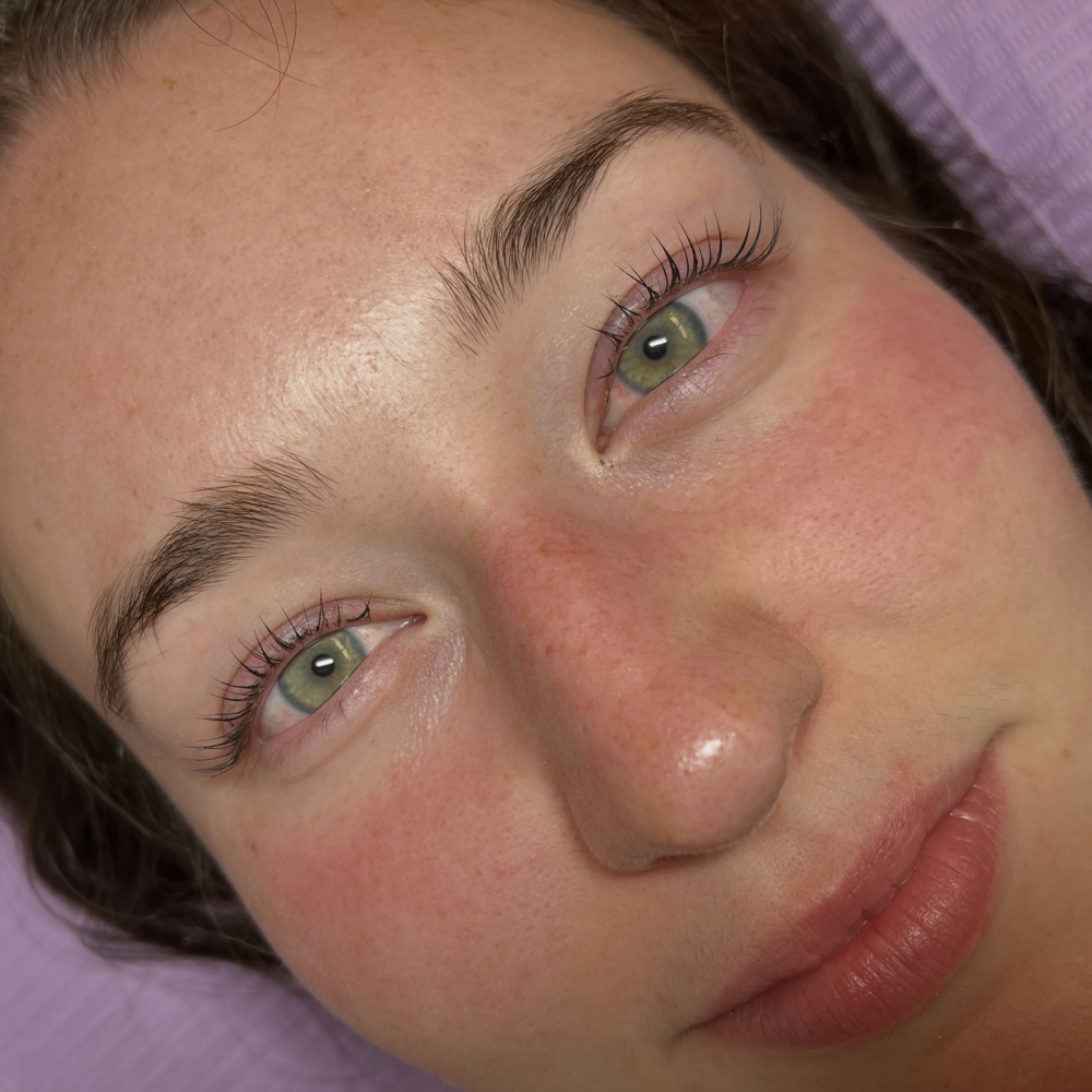 Korean Lift And Tint