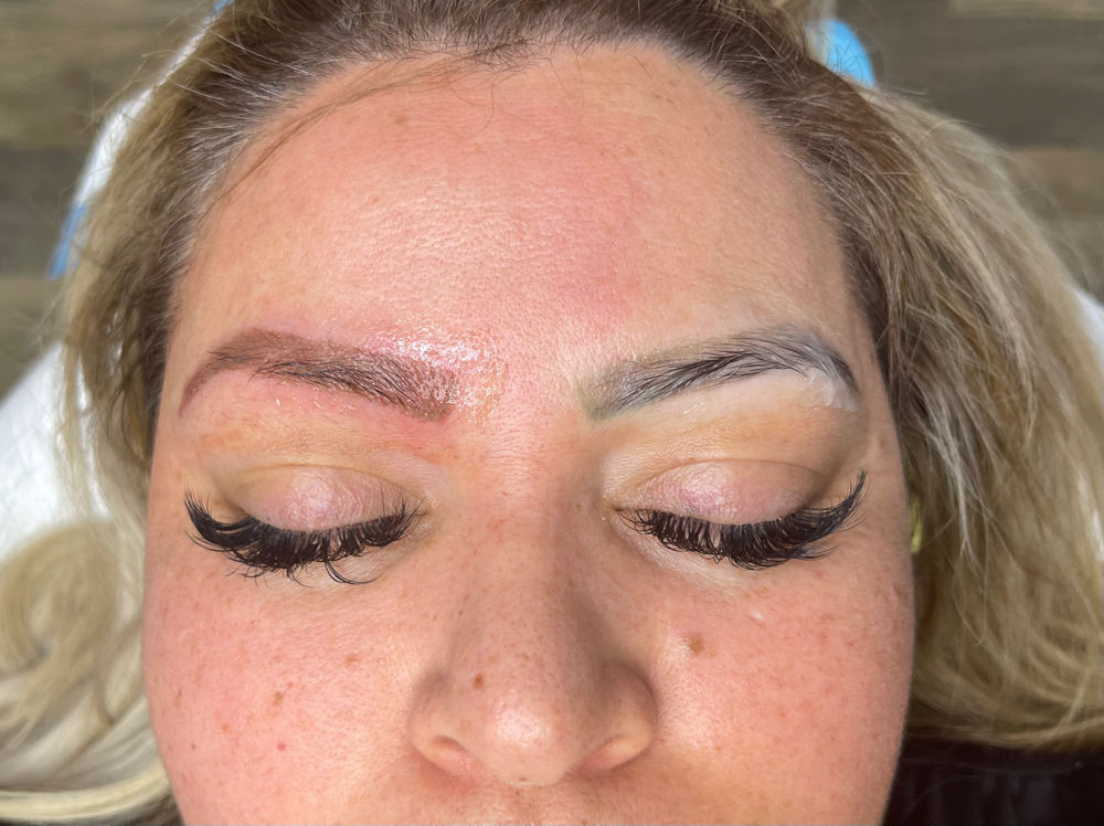 Saline Removal