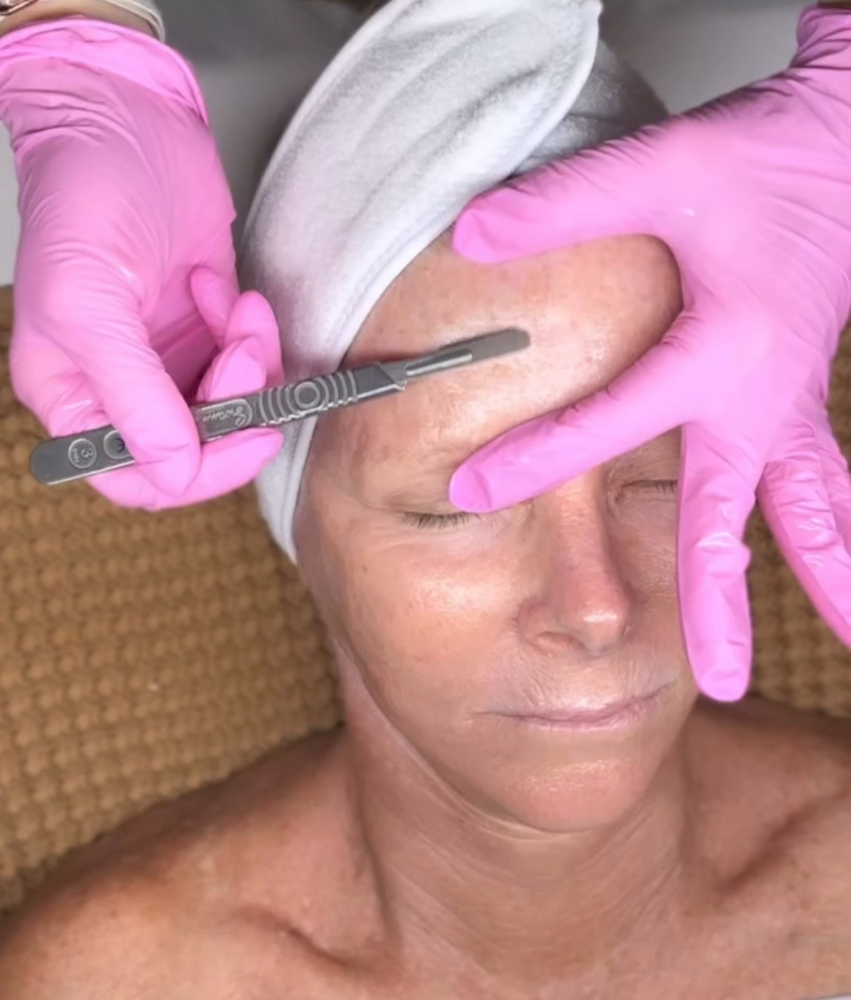 Dermaplaning Facial