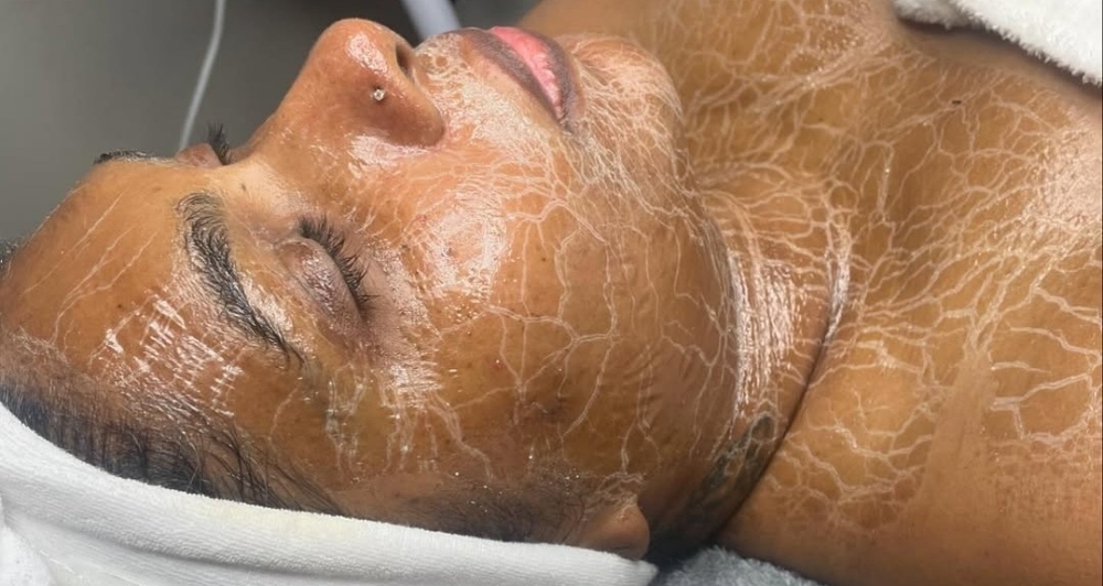 October Special - Zombie Facial