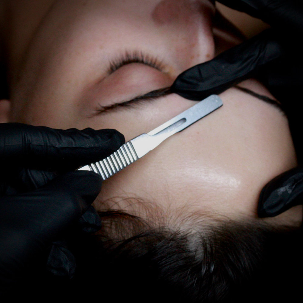 Dermaplane Treatment