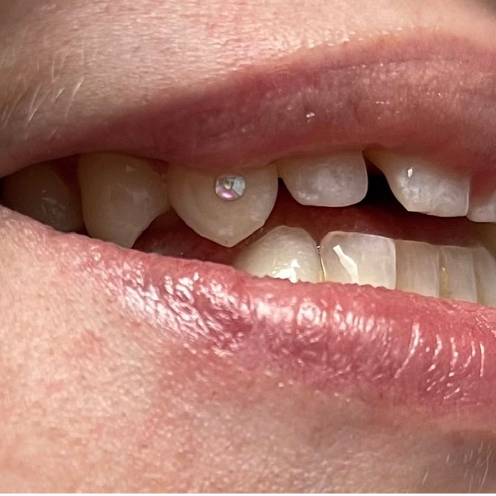Tooth Gem