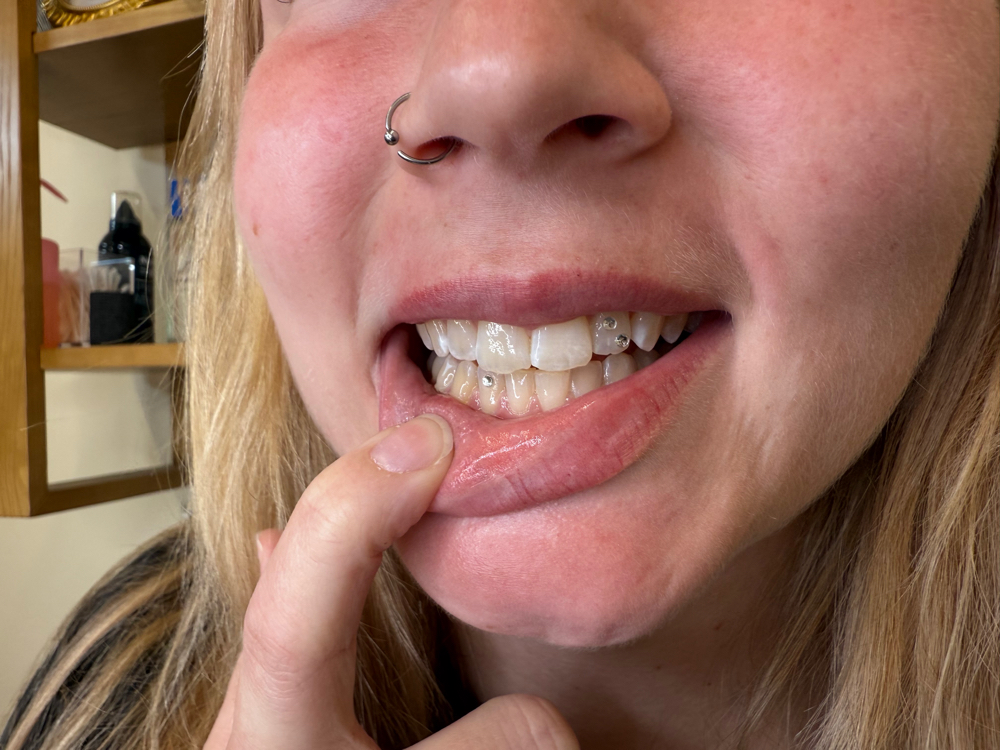Tooth Gems