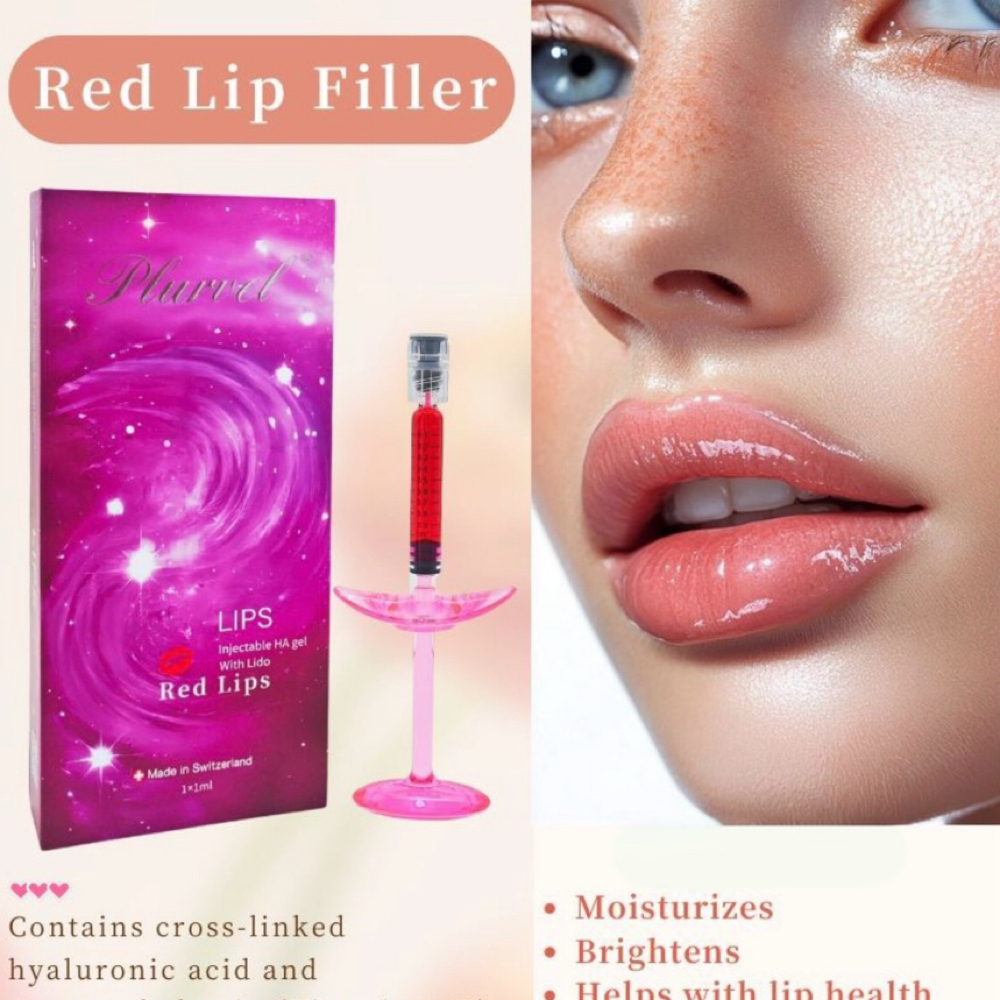 Lip filler with Vb12 at Injector Lucia in San Juan, TX