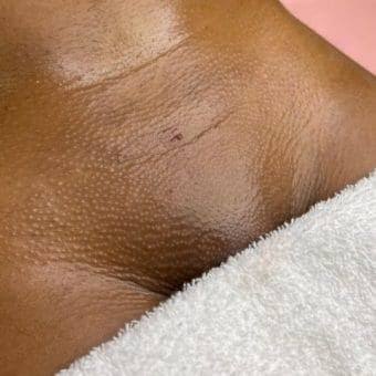 Brazilian Wax