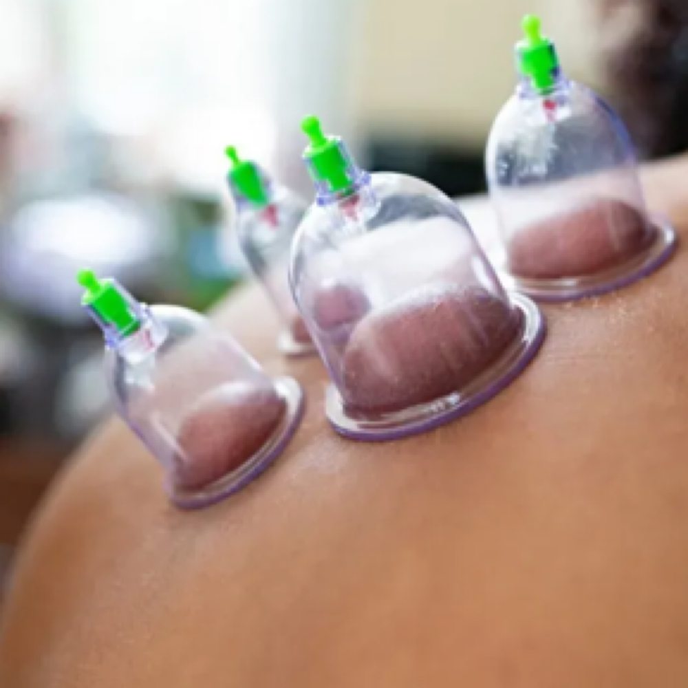 Cupping Enhancement at Rey Mindful Motion in Sun City, AZ