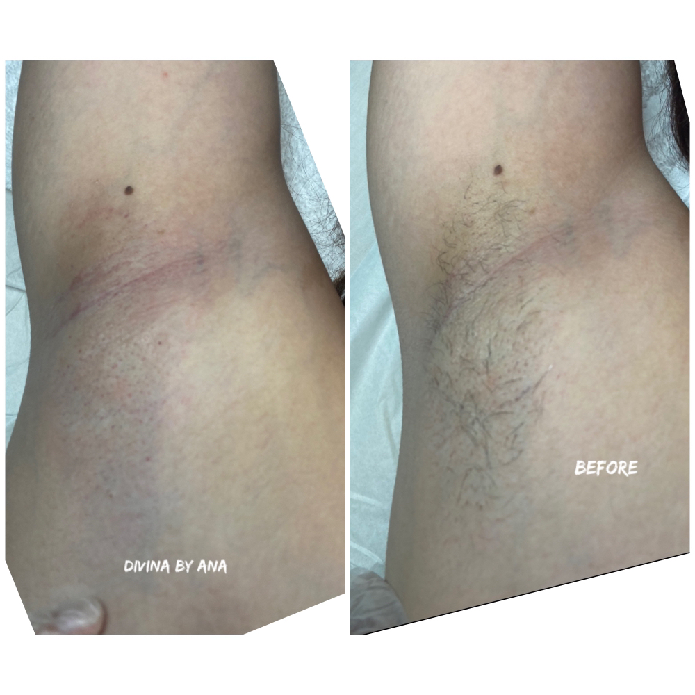 Underarm wax