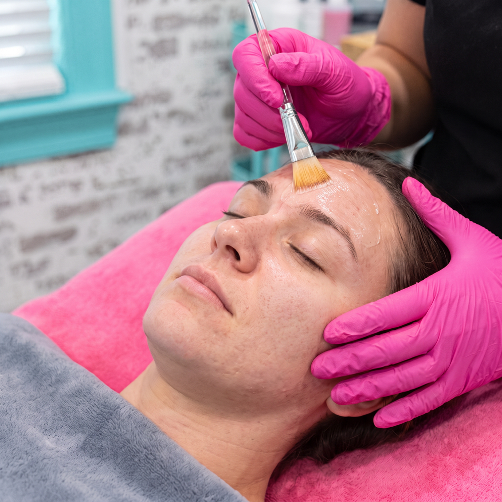 ⭐️PowerClear Peel-Acne/Congestion at Sinful Glow Skin Studio in Fuquay Varina, NC