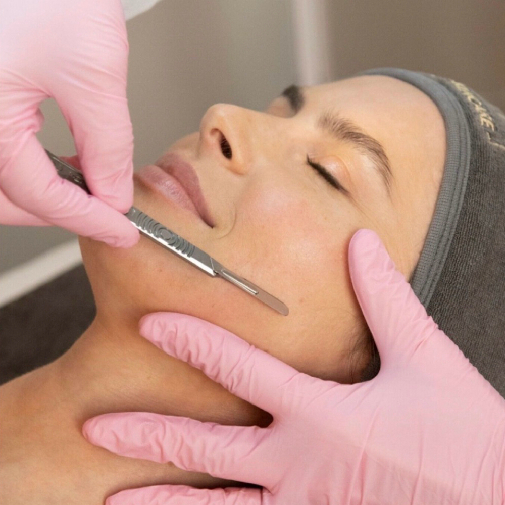 Dermaplaning Rev Facial at Revitalize Health in Florence, SC