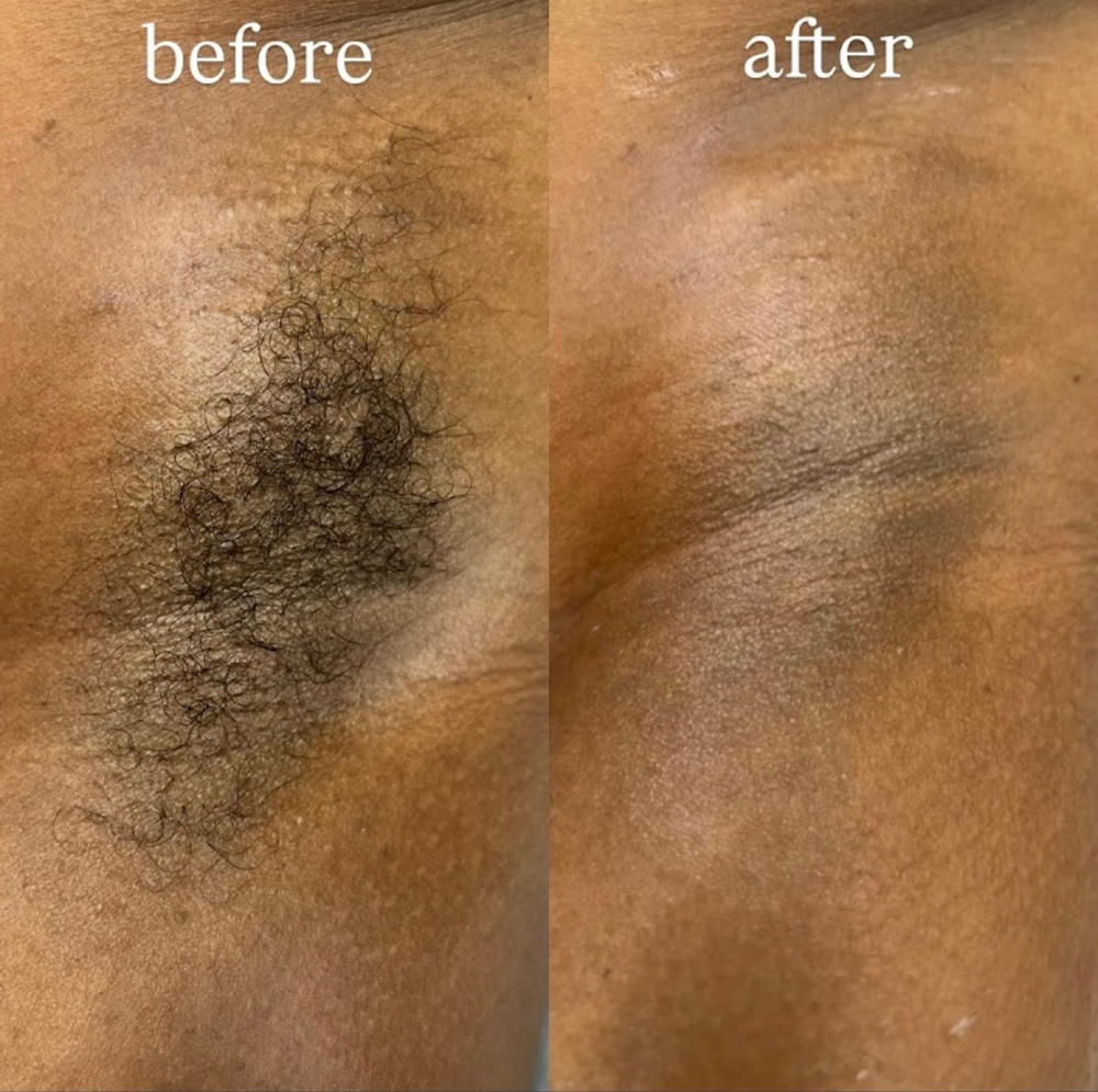 Underarm Wax