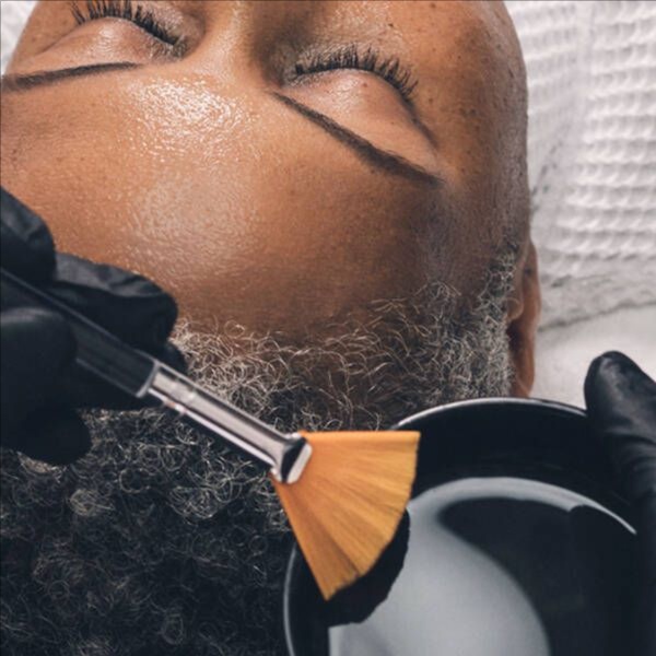 Chemical Peel buy 1 get 1 free at Milan Luxury Medspa in Spring, TX