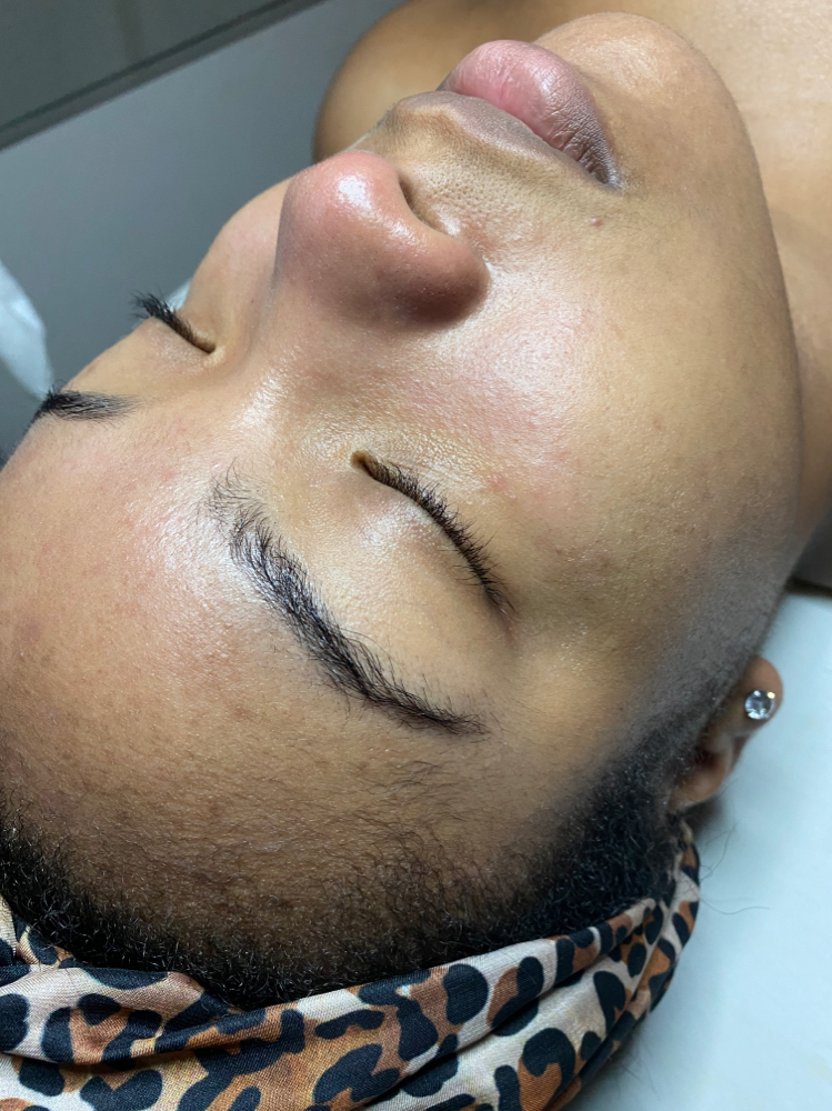 Rejuve Facial