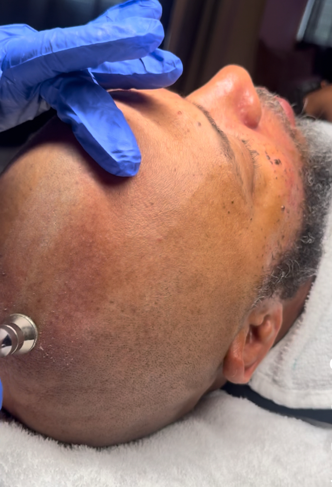 Royal Crown Treatment