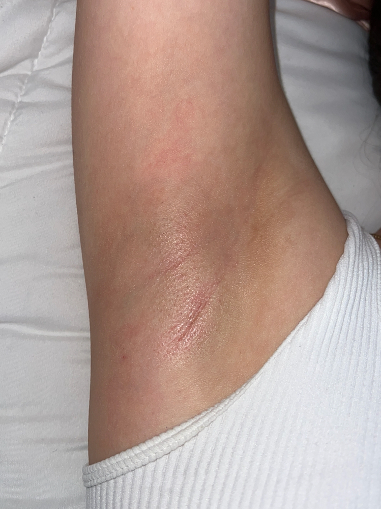 Underarm New Client at Bellarosawax in Redlands, CA