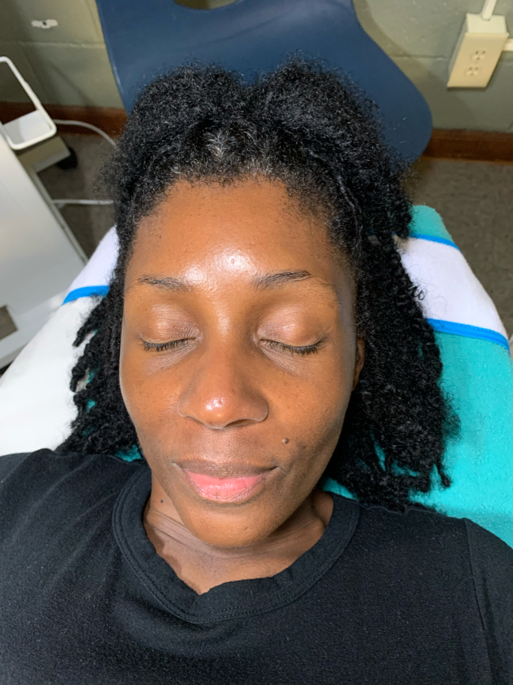 Dermaplane Facial