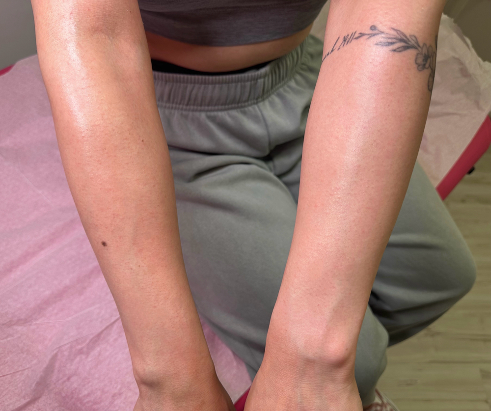 Arms