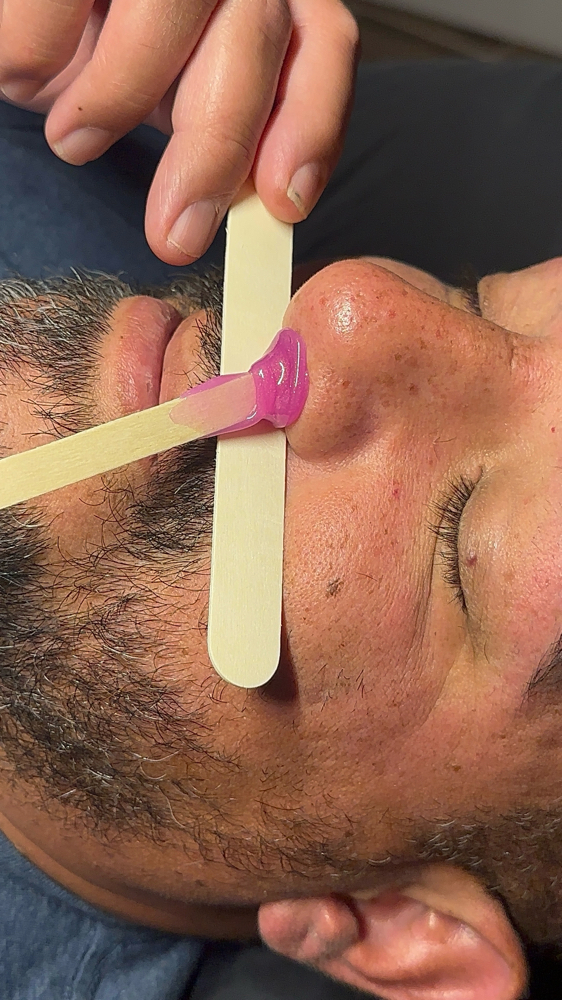 Nose Wax