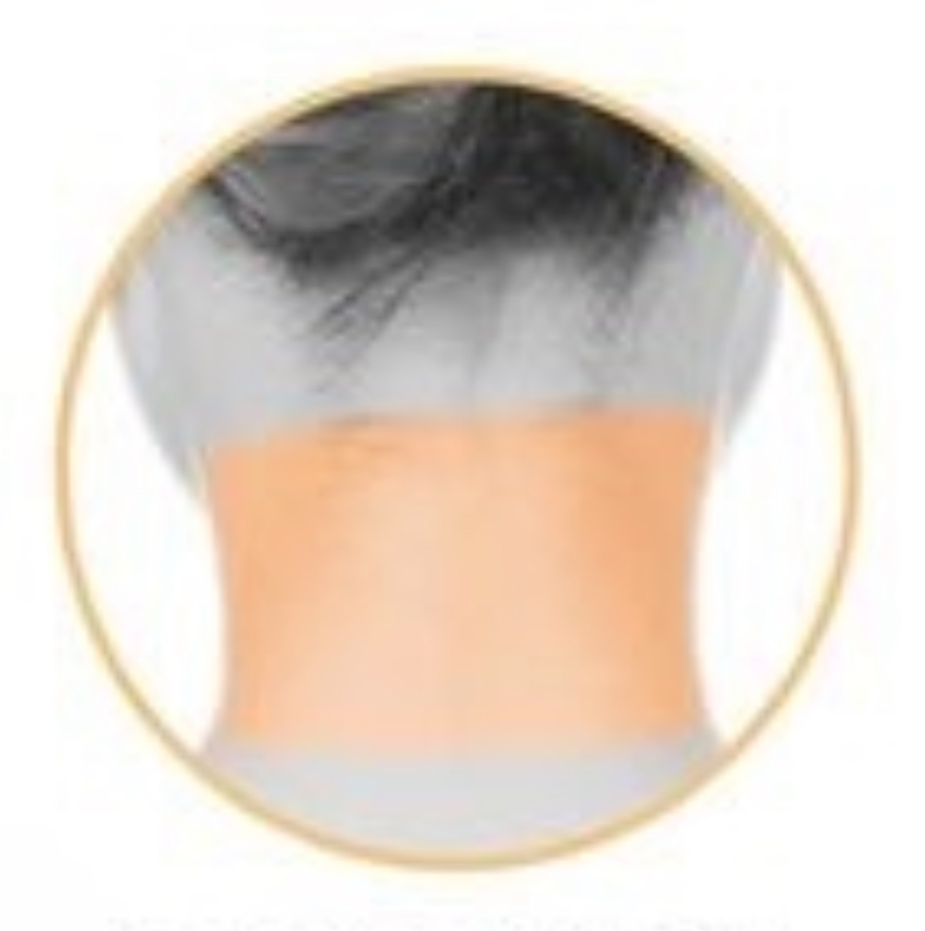 BACK OF NECK Laser Hair Removal