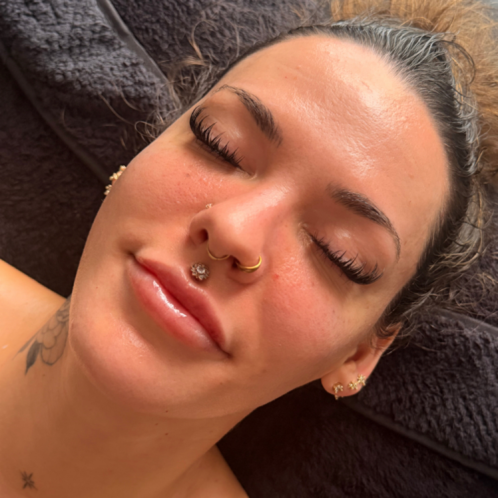 Barrier Repair at Esthetics By Karina in Oklahoma City, OK