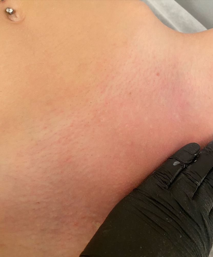 Brazilian Wax