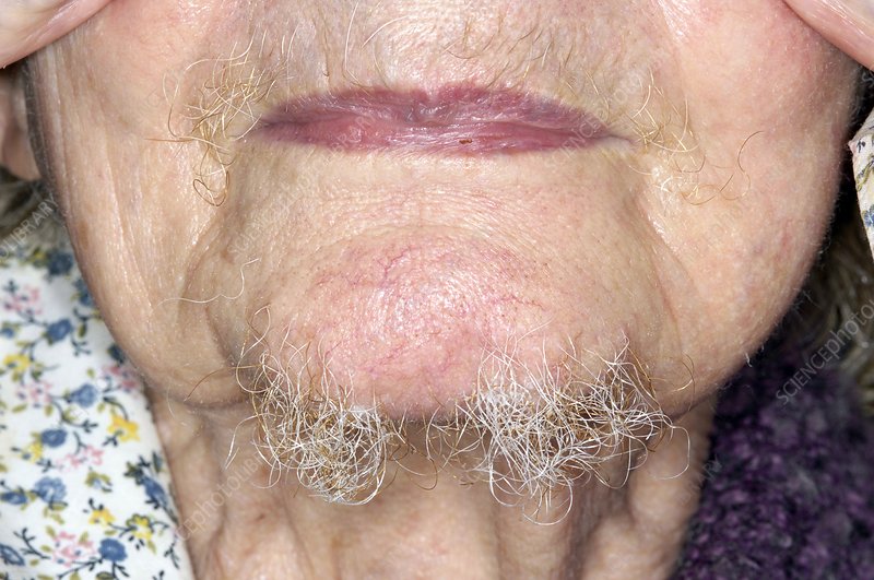 Chin Wax