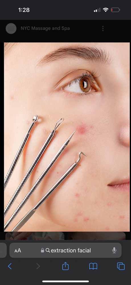 Extractions at DesireBeautyLab in Santan Valley, AZ