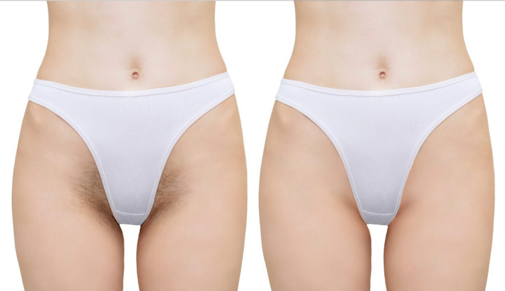 Bikinni Line Female